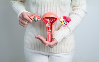 PCOS and the Gut: The Connection Your Doctor Isn’t Testing