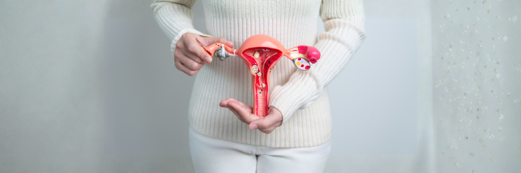 PCOS and the Gut: The Connection Your Doctor Isn’t Testing